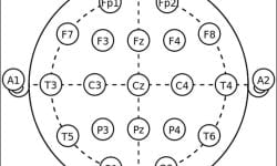 Nineteen-Point EEG and Evoked Potentials Tests